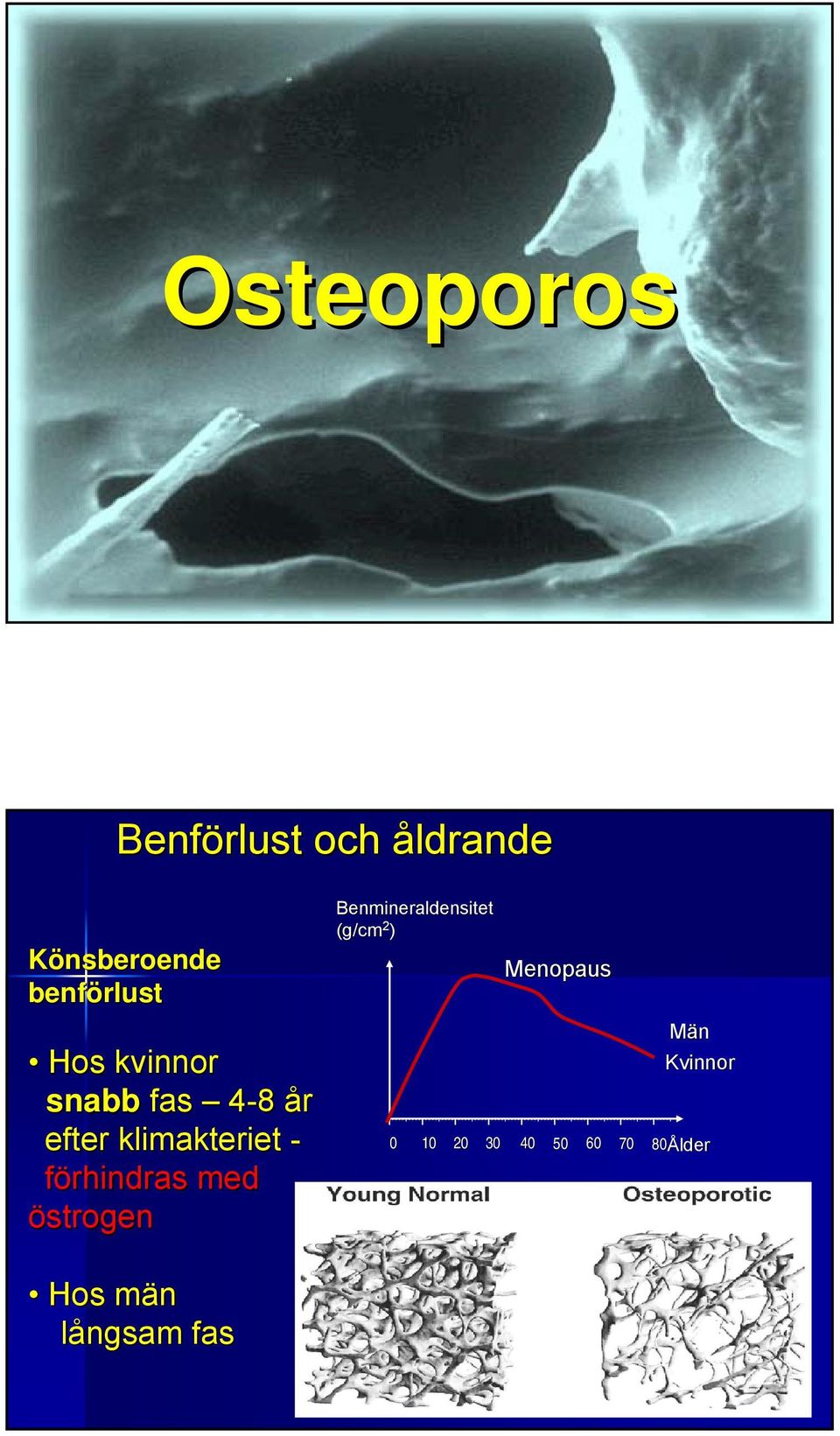 förhindras med östrogen Benmineraldensitet (g/cm 2 )