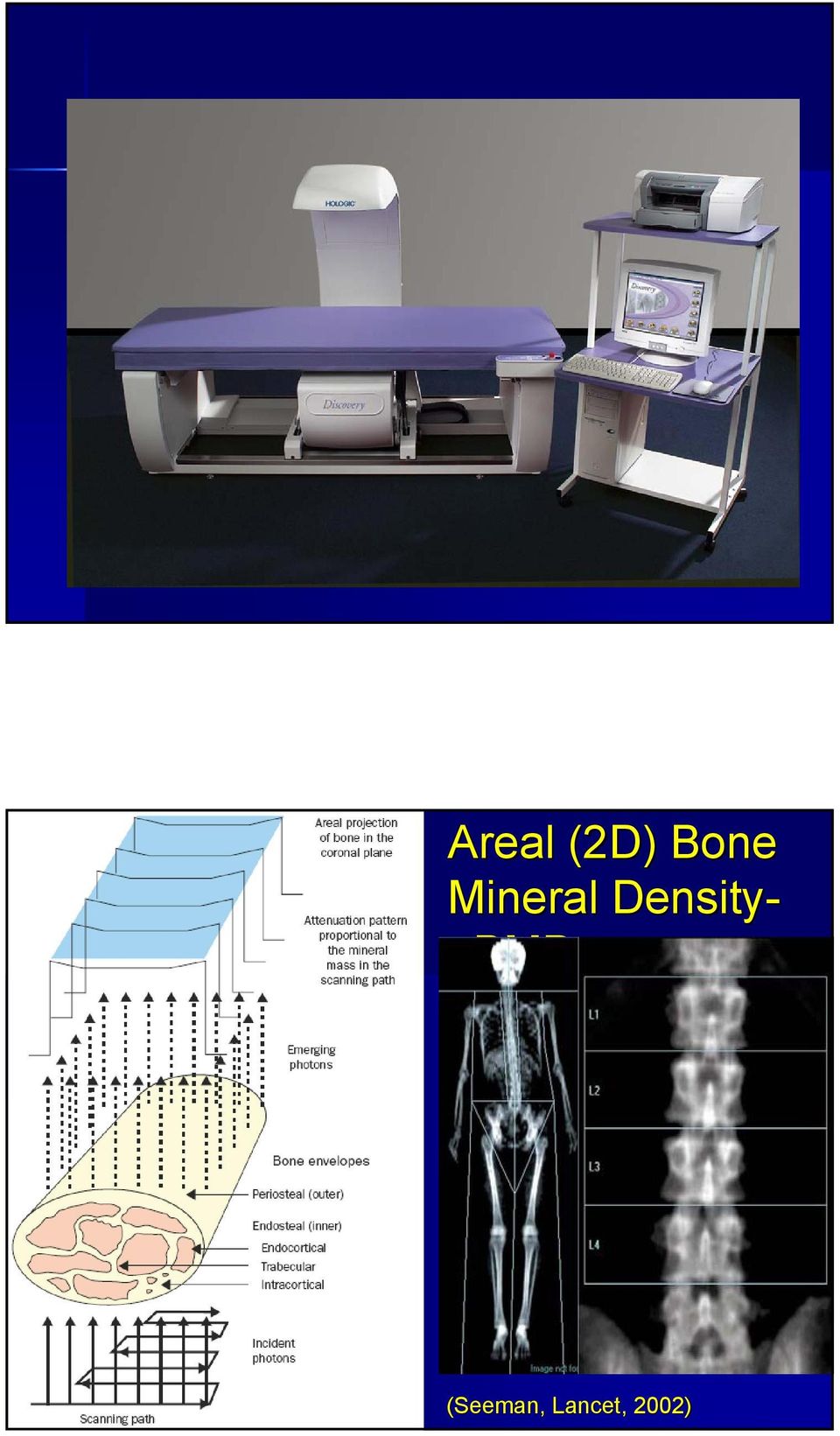 Density- abmd