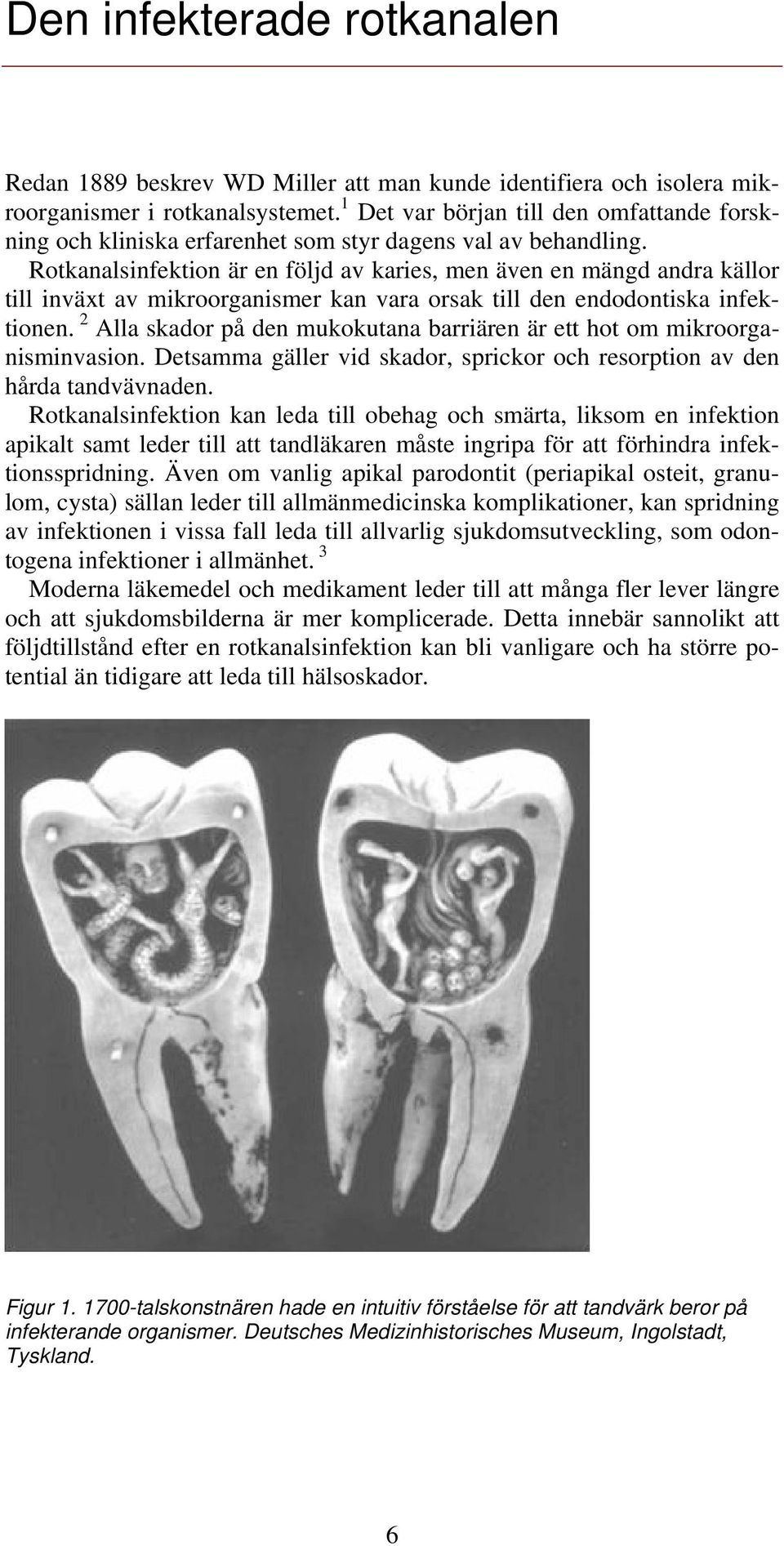 Rotkanalsinfektion är en följd av karies, men även en mängd andra källor till inväxt av mikroorganismer kan vara orsak till den endodontiska infektionen.