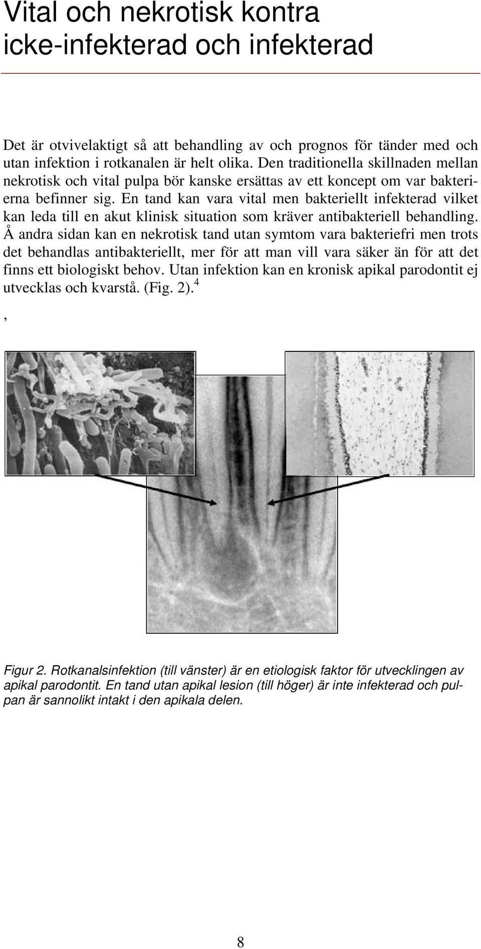 En tand kan vara vital men bakteriellt infekterad vilket kan leda till en akut klinisk situation som kräver antibakteriell behandling.