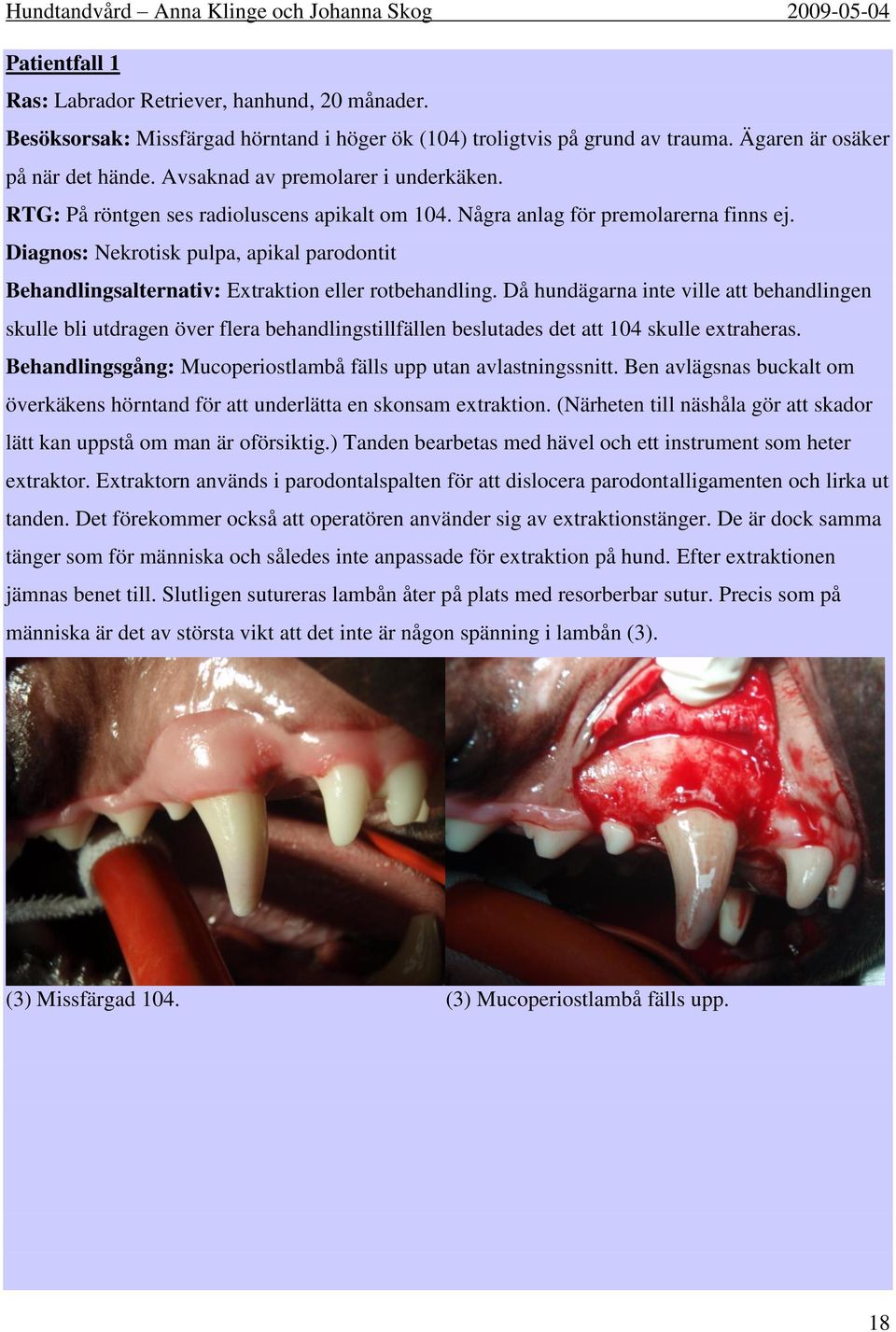 Diagnos: Nekrotisk pulpa, apikal parodontit Behandlingsalternativ: Extraktion eller rotbehandling.