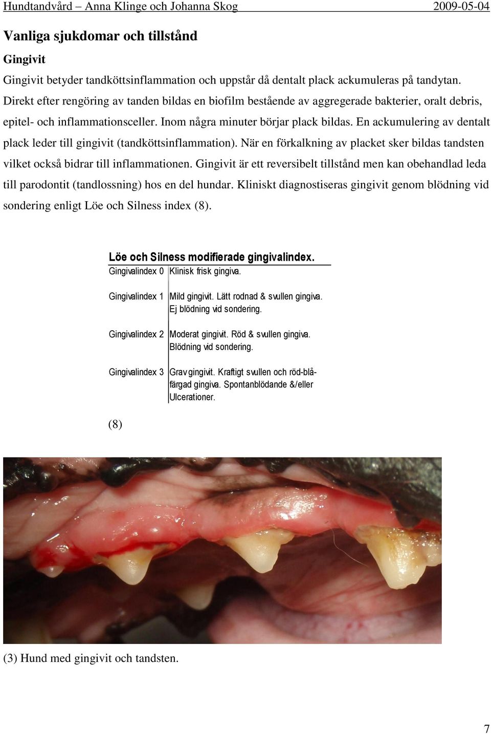 En ackumulering av dentalt plack leder till gingivit (tandköttsinflammation). När en förkalkning av placket sker bildas tandsten vilket också bidrar till inflammationen.