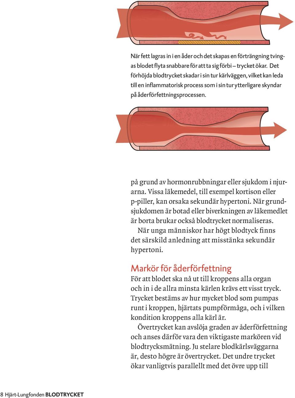 på grund av hormonrubbningar eller sjukdom i njurarna. Vissa läkemedel, till exempel kortison eller p-piller, kan orsaka sekundär hypertoni.