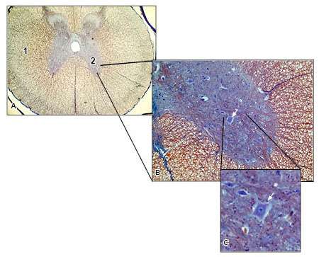 4. Bilden nedan visar ett tvärsnitt av ryggmärg i olika förstoringsgrad (A lägst och C högst). Nervvävnaden visar ett specifikt arrangemang, både histologiskt och funktionellt. a) Bild A.