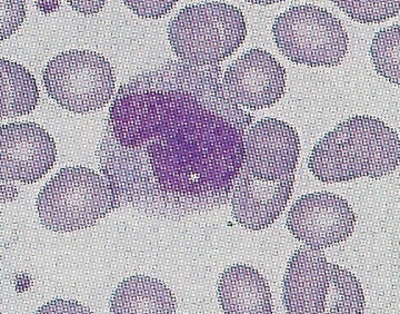 scatter Monocyter Lymfocyter Lite granula