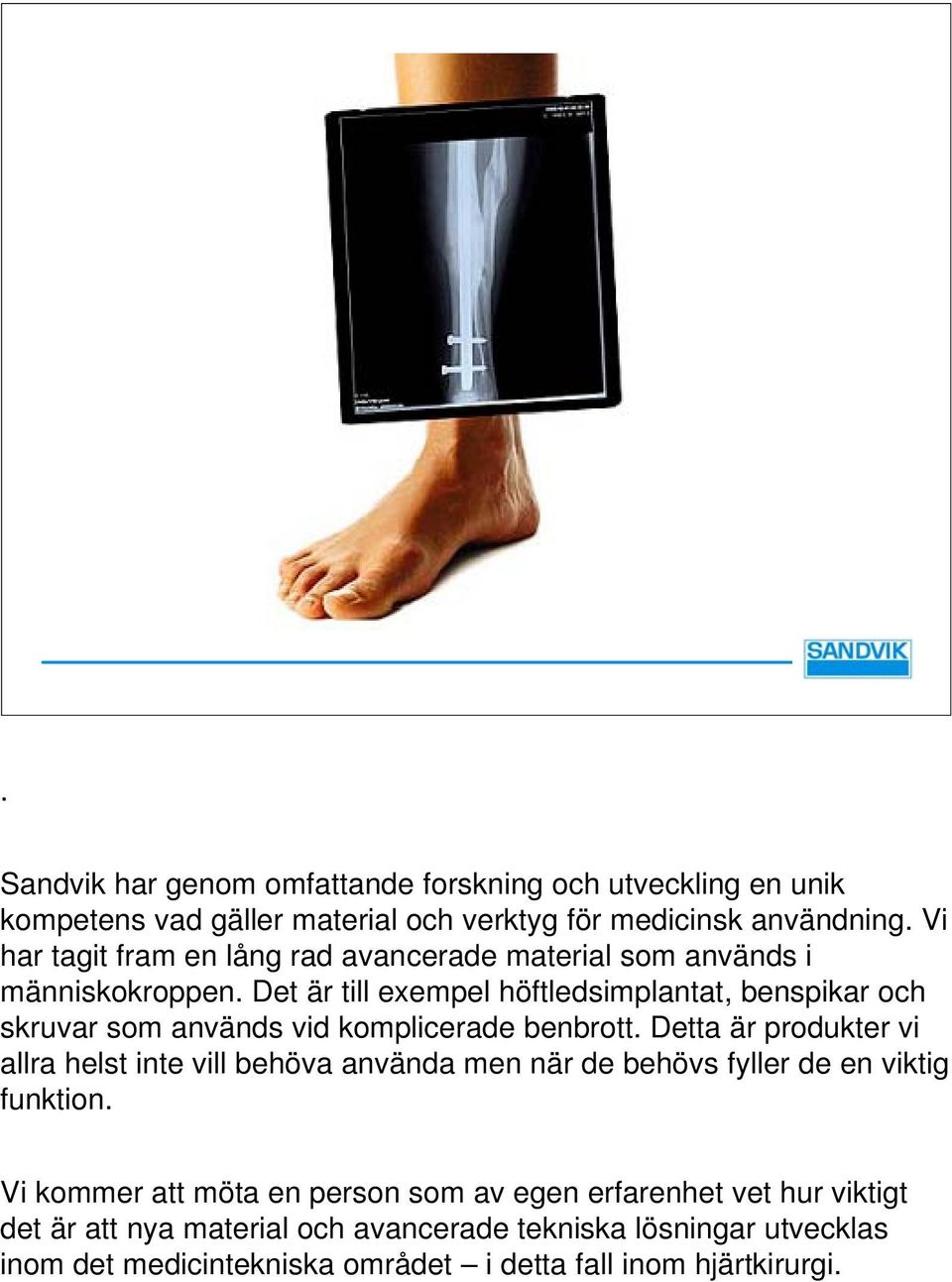 Det är till exempel höftledsimplantat, benspikar och skruvar som används vid komplicerade benbrott.