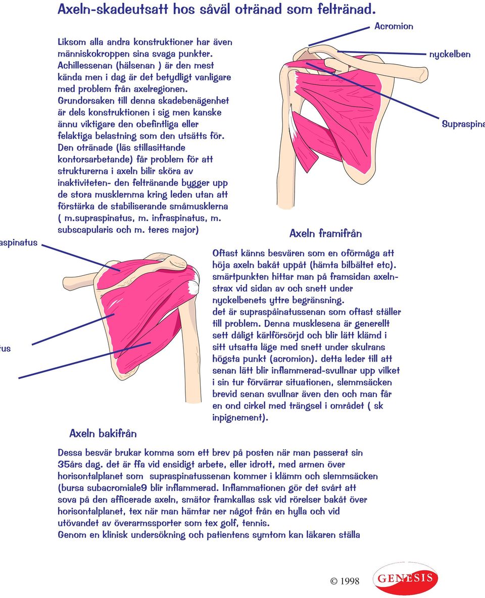 Grundorsaken till denna skadebenägenhet är dels konstruktionen i sig men kanske ännu viktigare den obefintliga eller felaktiga belastning som den utsätts för.