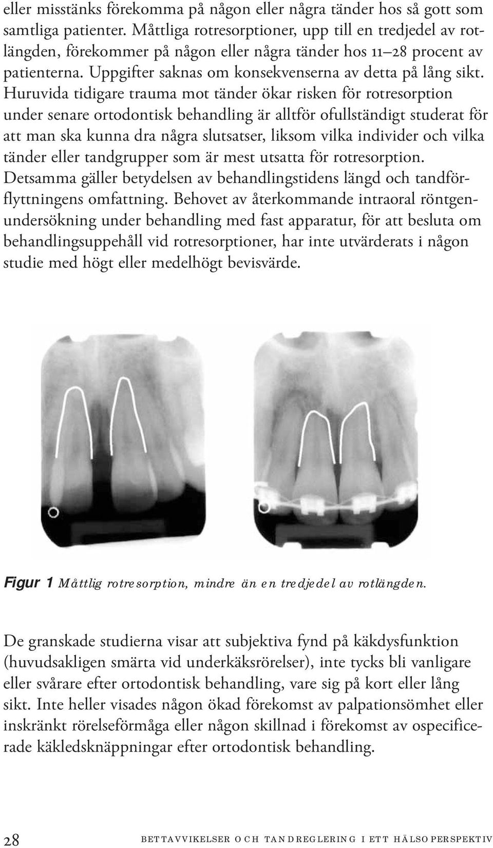 Huruvida tidigare trauma mot tänder ökar risken för rotresorption under senare ortodontisk behandling är alltför ofullständigt studerat för att man ska kunna dra några slutsatser, liksom vilka