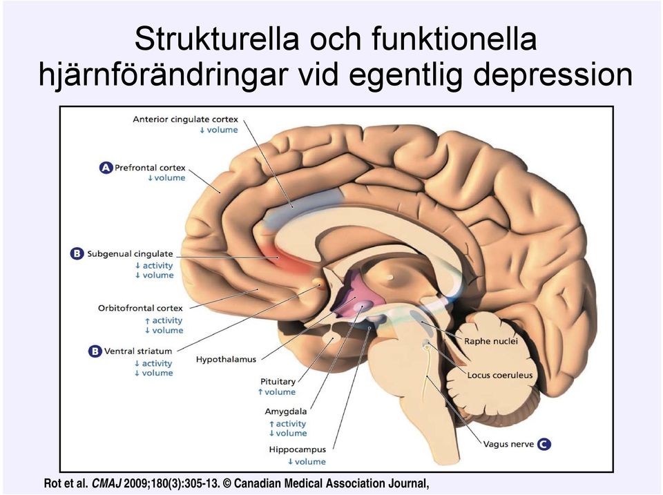 depression Rot et al.