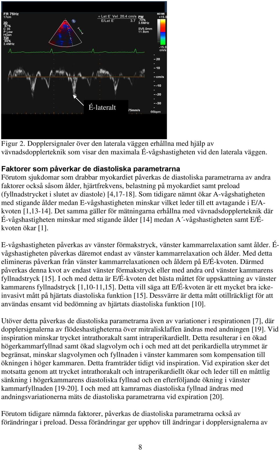 myokardiet samt preload (fyllnadstrycket i slutet av diastole) [4,17-18].