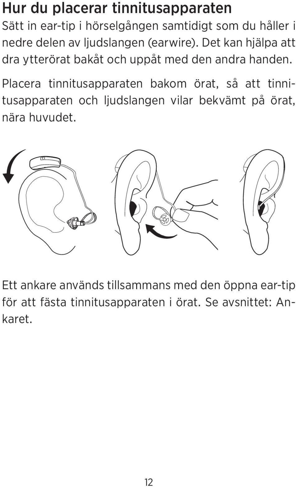 Placera tinnitusapparaten bakom örat, så att tinnitusapparaten och ljudslangen vilar bekvämt på örat, nära