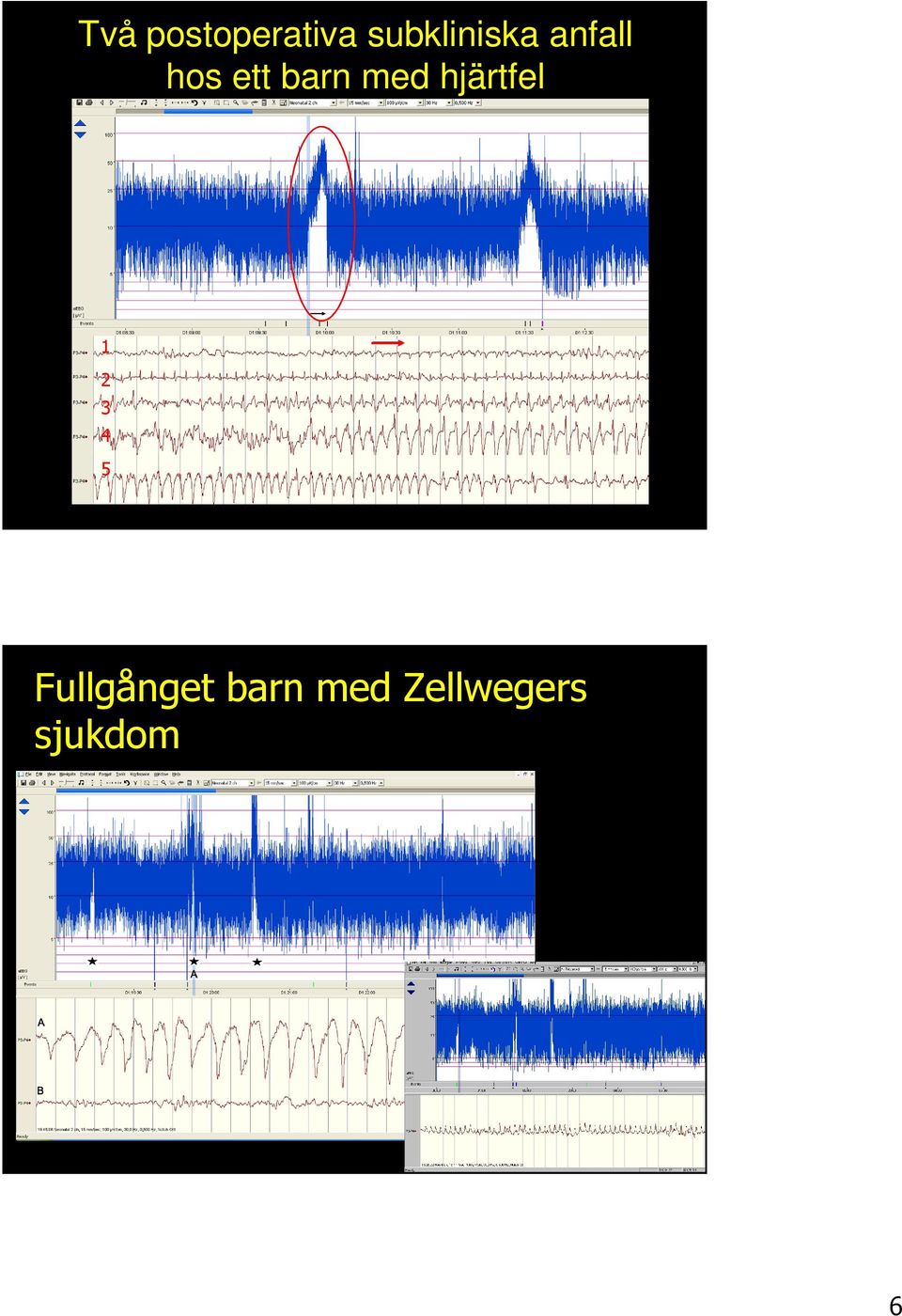 de Vries, Rosén. Atlas of aeeg in the Newborn.