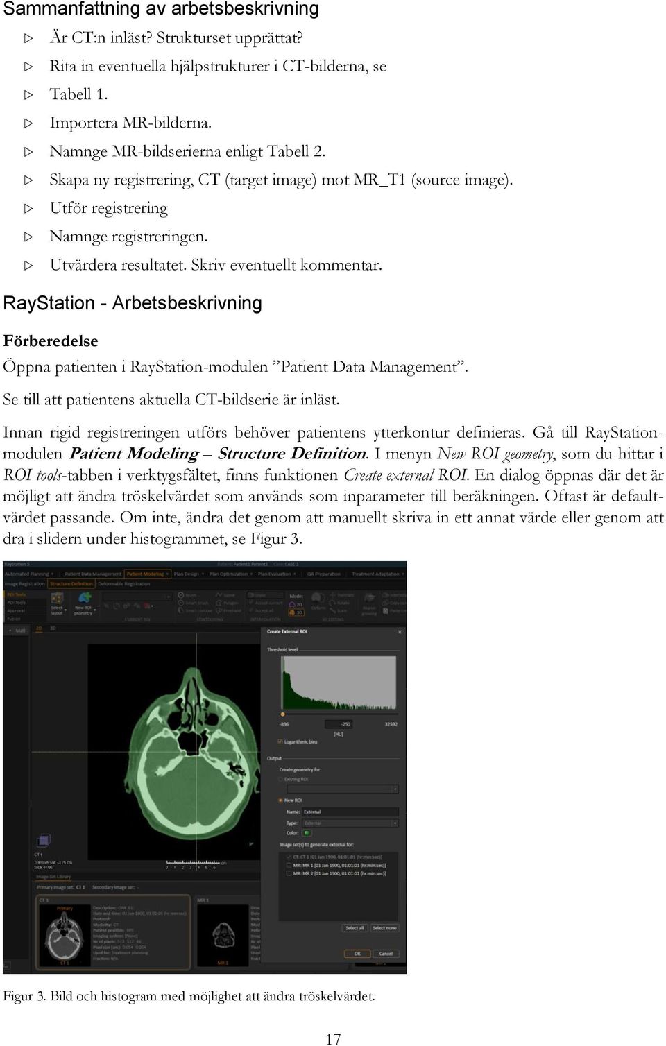 RayStation - Arbetsbeskrivning Förberedelse Öppna patienten i RayStation-modulen Patient Data Management. Se till att patientens aktuella CT-bildserie är inläst.