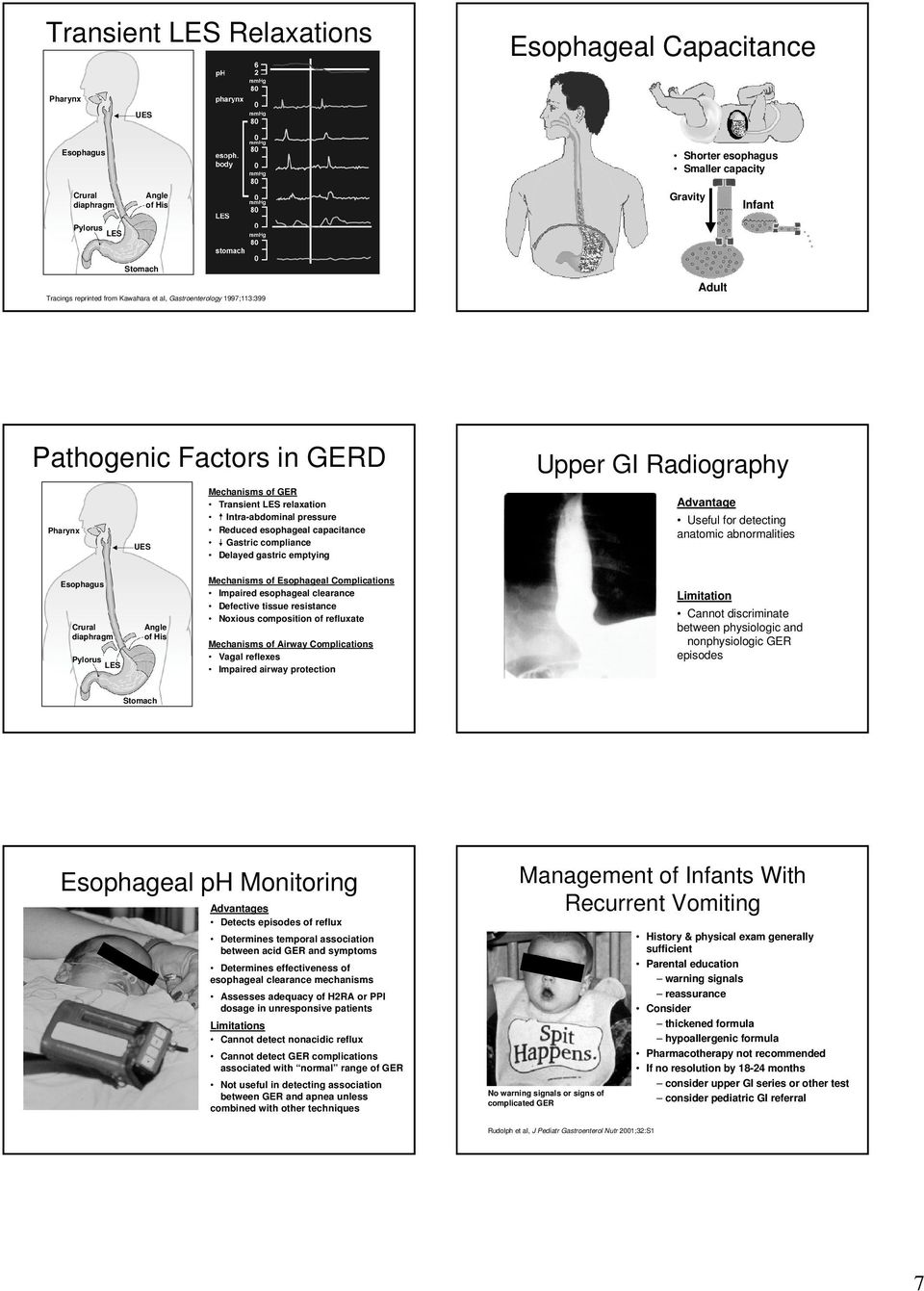 compliance Delayed gastric emptying Upper GI Radiography Advantage Useful for detecting anatomic abnormalities Esophagus Crural diaphragm Pylorus LES Angle of His Mechanisms of Esophageal