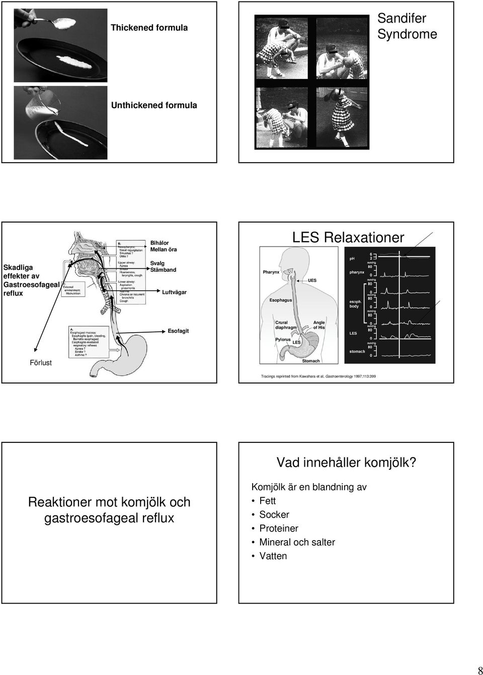 His Förlust Stomach Tracings reprinted from Kawahara et al, Gastroenterology 1997;113:399 Vad innehåller komjölk?