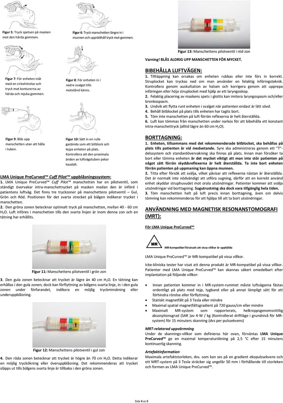 Figur 13: Manschettens pilotventil i röd zon Varning! BLÅS ALDRIG UPP MANSCHETTEN FÖR MYCKET. BIBEHÅLLA LUFTVÄGEN: 1. Tilltäppning kan orsakas om enheten rubbas eller inte förs in korrekt.