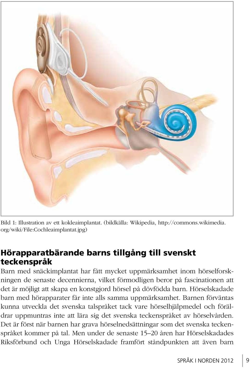 fascinationen att det är möjligt att skapa en konstgjord hörsel på dövfödda barn. Hörselskadade barn med hörapparater får inte alls samma uppmärksamhet.