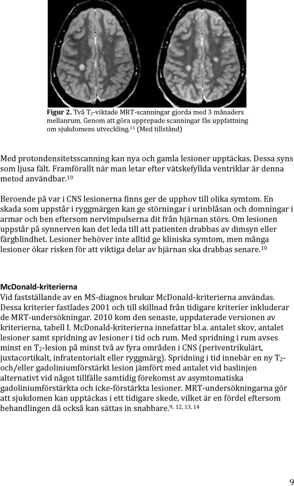 10 Beroende på var i CNS lesionerna finns ger de upphov till olika symtom.