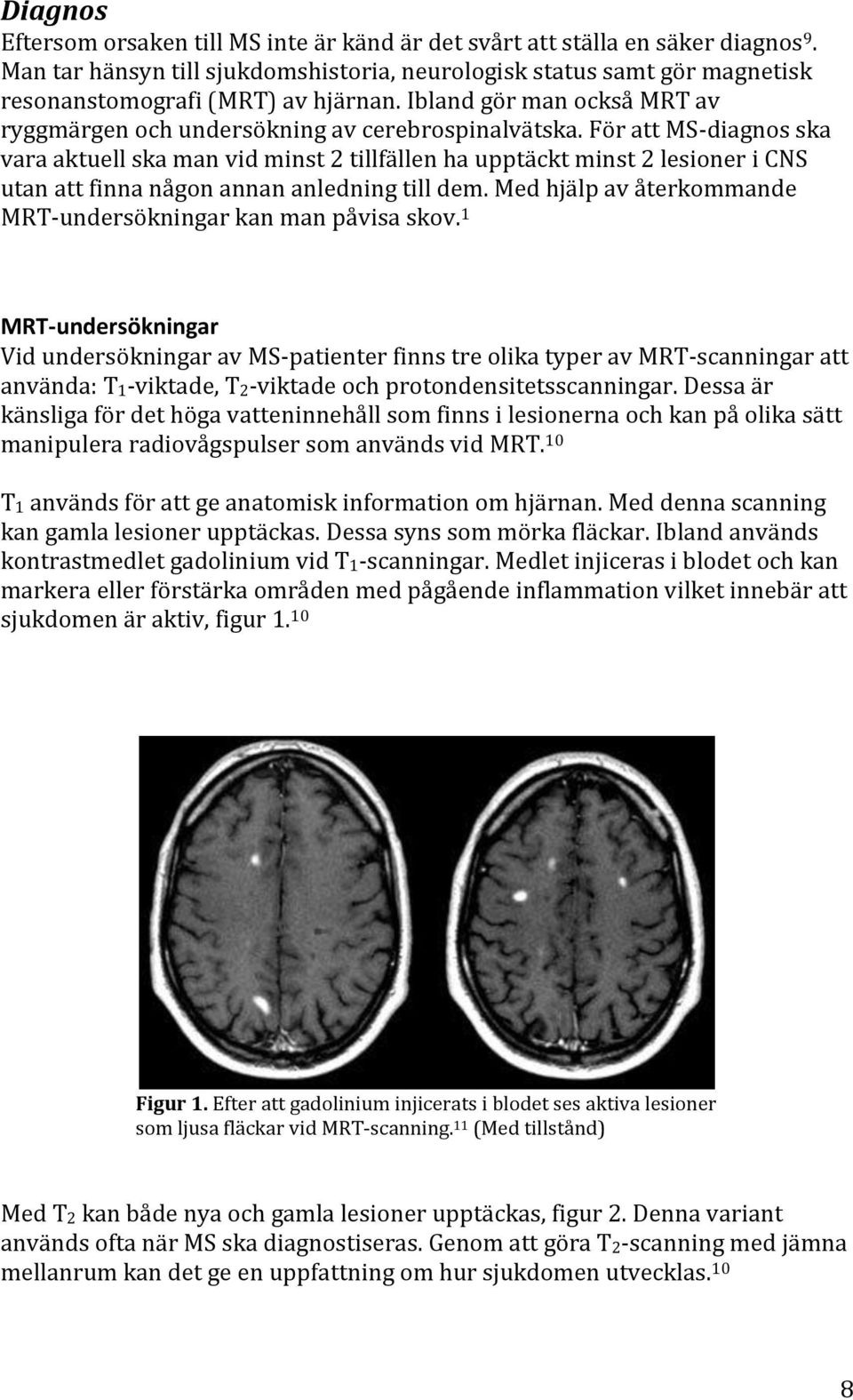 För att MS-diagnos ska vara aktuell ska man vid minst 2 tillfällen ha upptäckt minst 2 lesioner i CNS utan att finna någon annan anledning till dem.