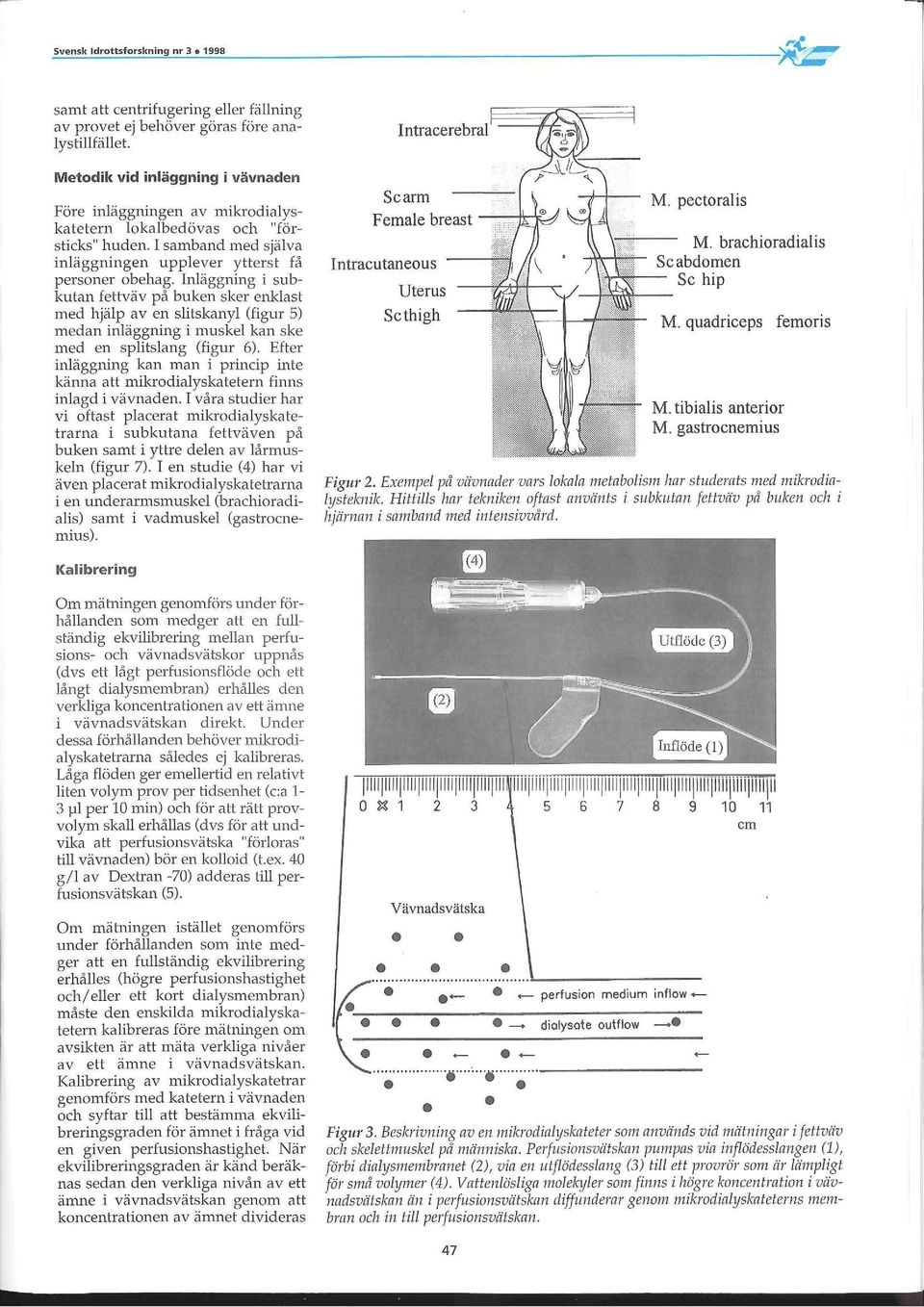 Inläggning i subkutan fettväv på buken sker enklast med hjälp av en slitskanyl (figur 5) medan inläggning i muskel kan ske med en splitslang (figur 6).