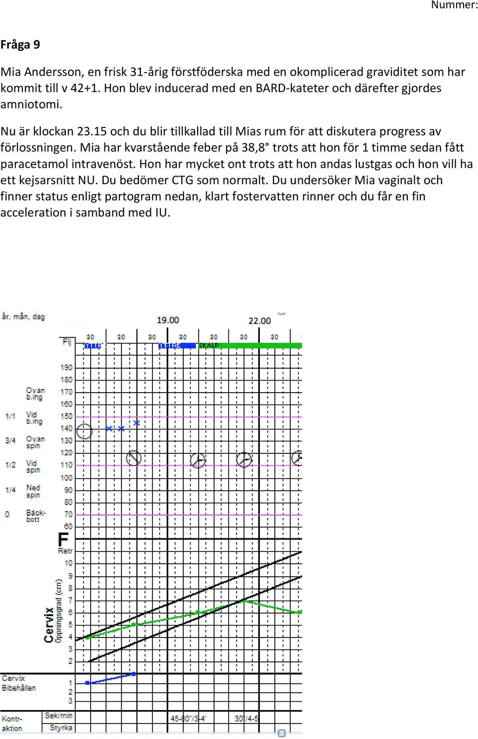 15 och du blir tillkallad till Mias rum för att diskutera progress av förlossningen.