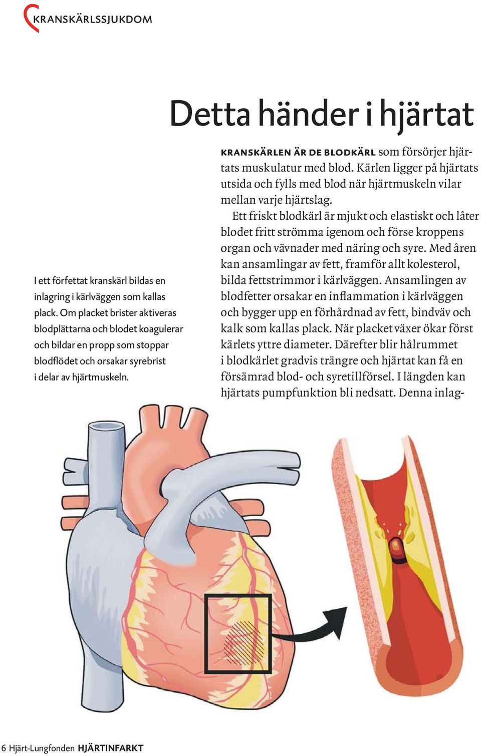 Kärlen ligger på hjärtats utsida och fylls med blod när hjärtmuskeln vilar mellan varje hjärtslag.