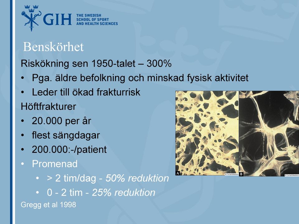 frakturrisk Höftfrakturer 20.000 per år flest sängdagar 200.