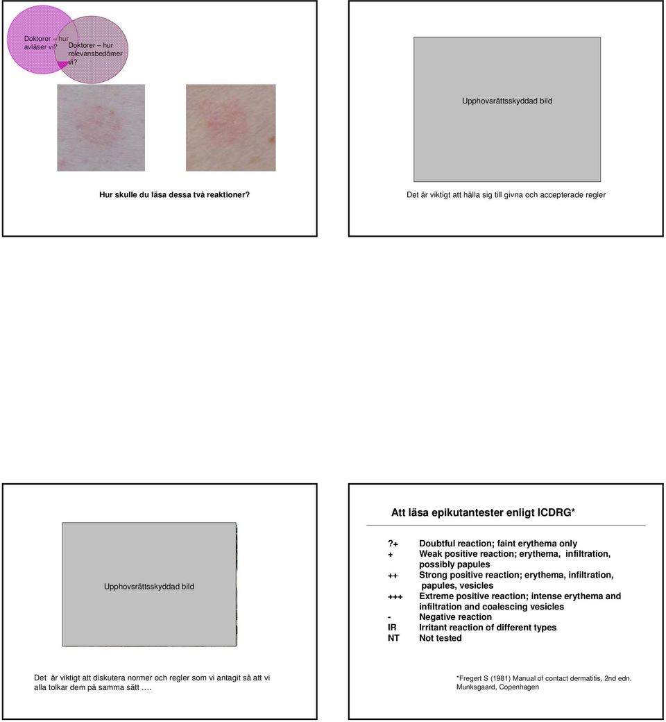 + Doubtful reaction; faint erythema only + Weak positive reaction; erythema, infiltration, possibly papules ++ Strong positive reaction; erythema, infiltration, papules, vesicles