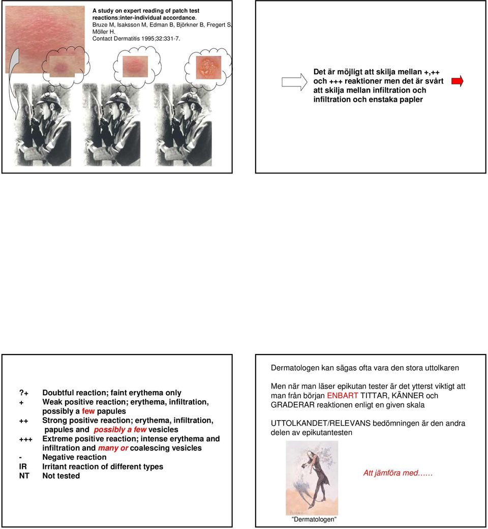 + Doubtful reaction; faint erythema only + Weak positive reaction; erythema, infiltration, possibly a few papules ++ Strong positive reaction; erythema, infiltration, papules and possibly a few