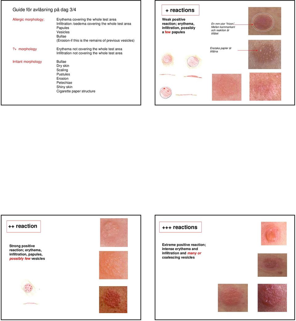 + morphology Erythema not covering the whole test area Infiltration not covering the whole test area Enstaka papler är tillåtna Irritant morphology Bullae Dry skin Scaling Pustules Erosion Petechiae