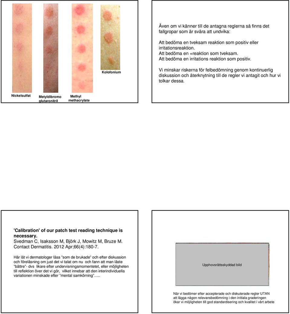 Nickelsulfat Metyldibromo glutaronitril Methyl methacrylate 'Calibration' of our patch test reading technique is necessary. Svedman C, Isaksson M, Björk J, Mowitz M, Bruze M. Contact Dermatitis.