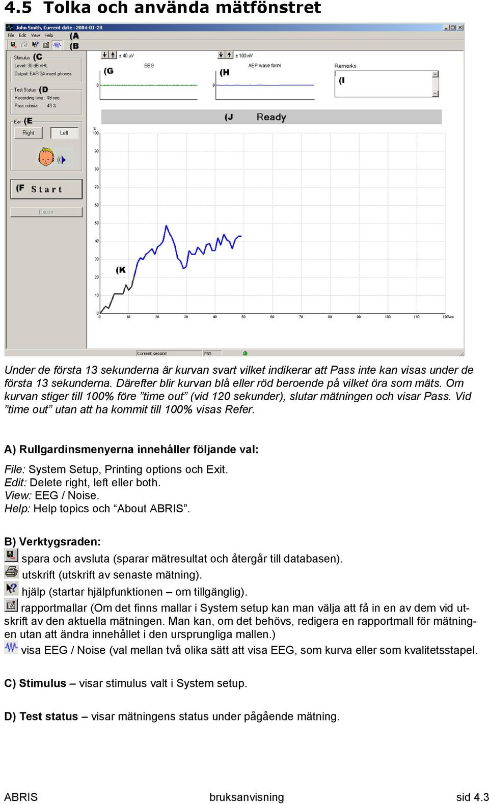 Vid time out utan att ha kommit till 100% visas Refer. A) Rullgardinsmenyerna innehåller följande val: File: System Setup, Printing options och Exit. Edit: Delete right, left eller both.