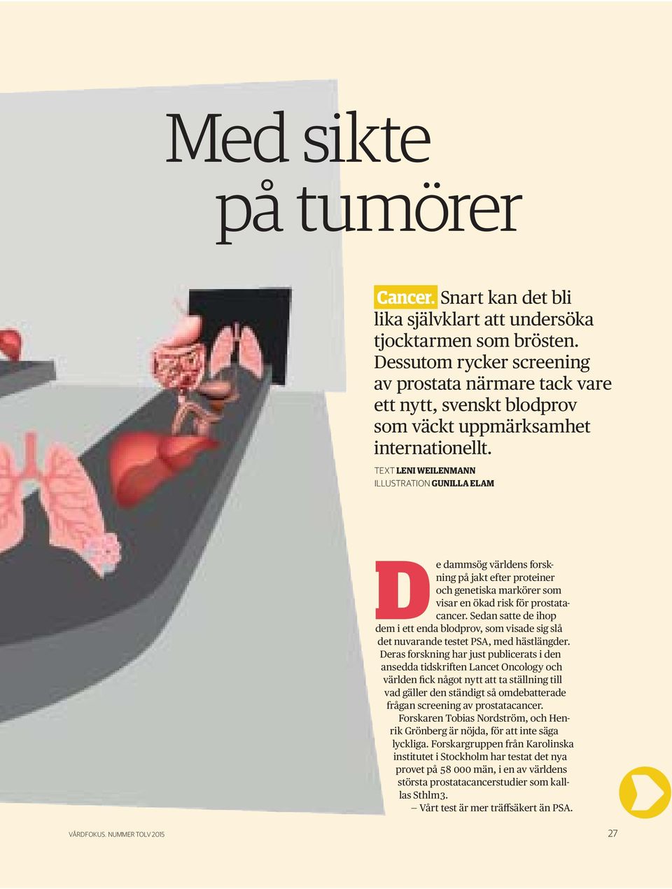 TEXT LENI WEILENMANN ILLUSTRATION GUNILLA ELAM De dammsög världens forskning på jakt efter proteiner och genetiska markörer som visar en ökad risk för prostatacancer.