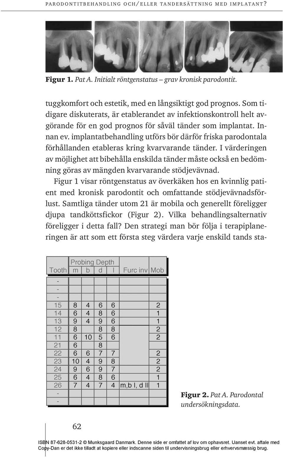 implantatbehandling utförs bör därför friska parodontala förhållanden etableras kring kvarvarande tänder.