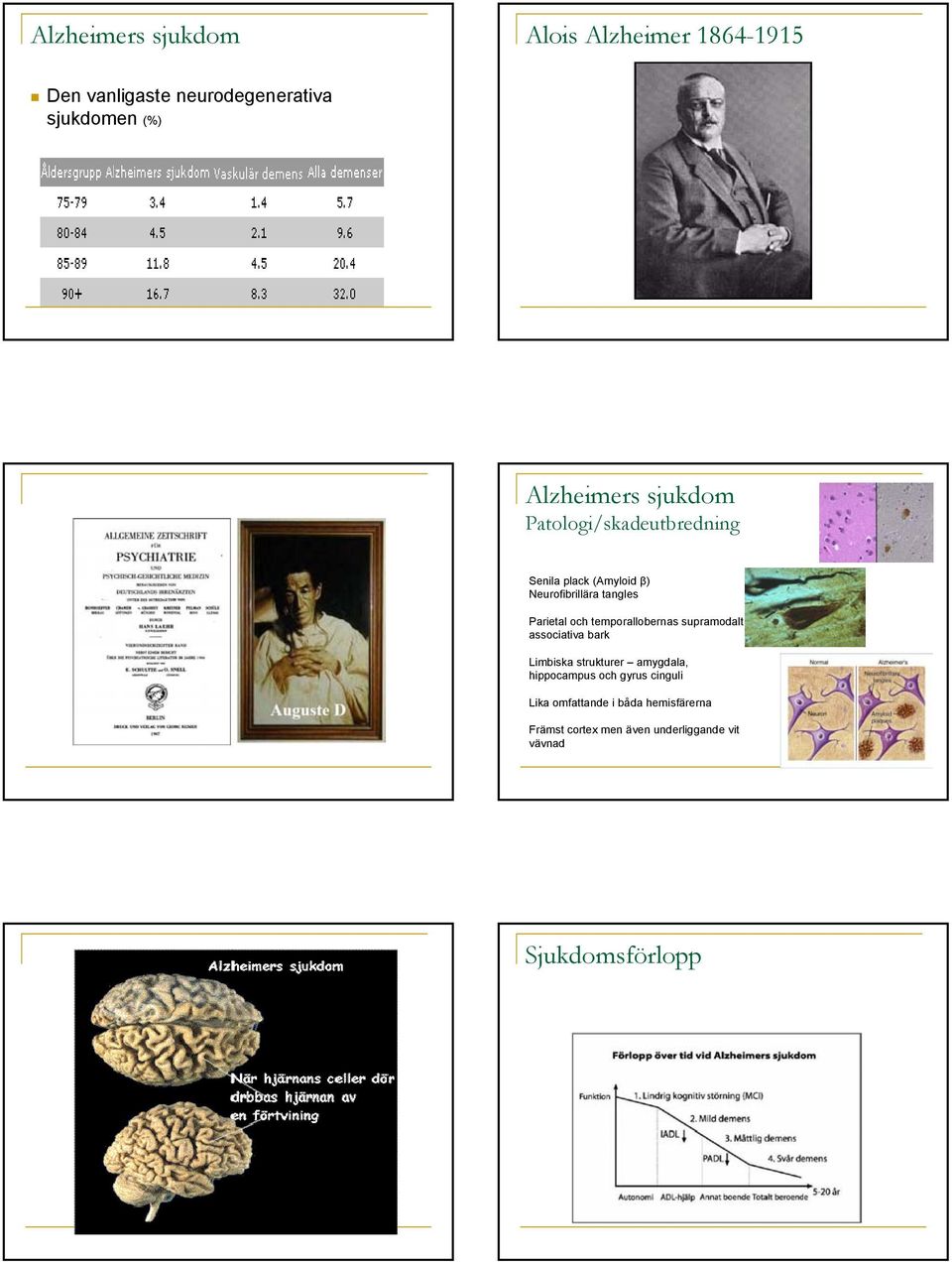 Parietal och temporallobernas supramodalt associativa bark Limbiska strukturer amygdala, hippocampus