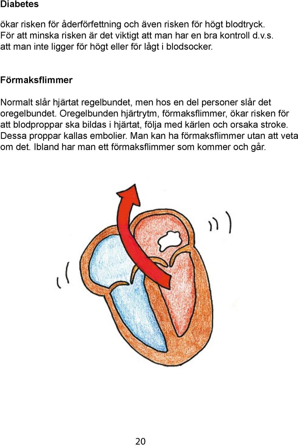 Förmaksflimmer Normalt slår hjärtat regelbundet, men hos en del personer slår det oregelbundet.