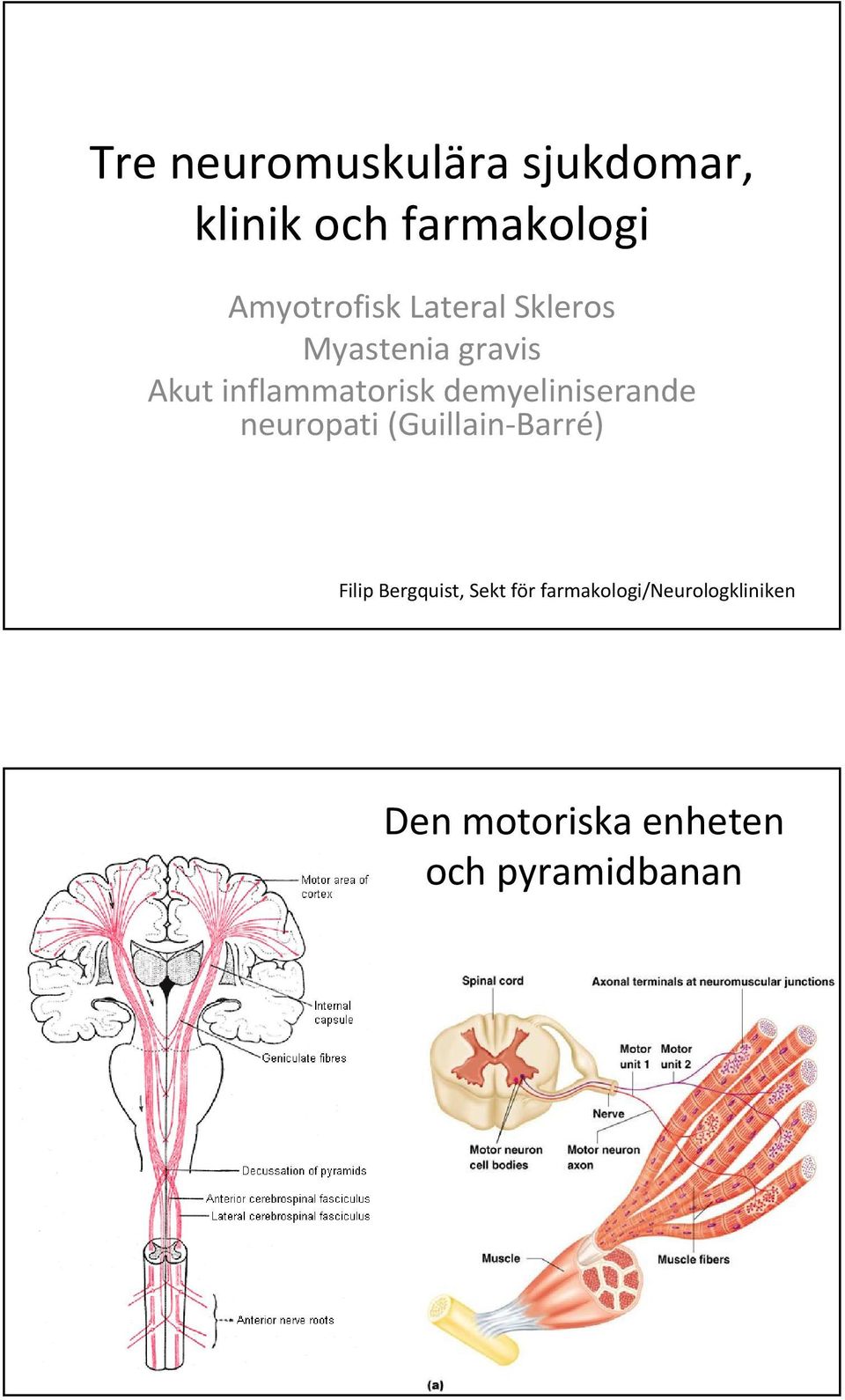 inflammatorisk demyeliniserande neuropati (Guillain-Barré)