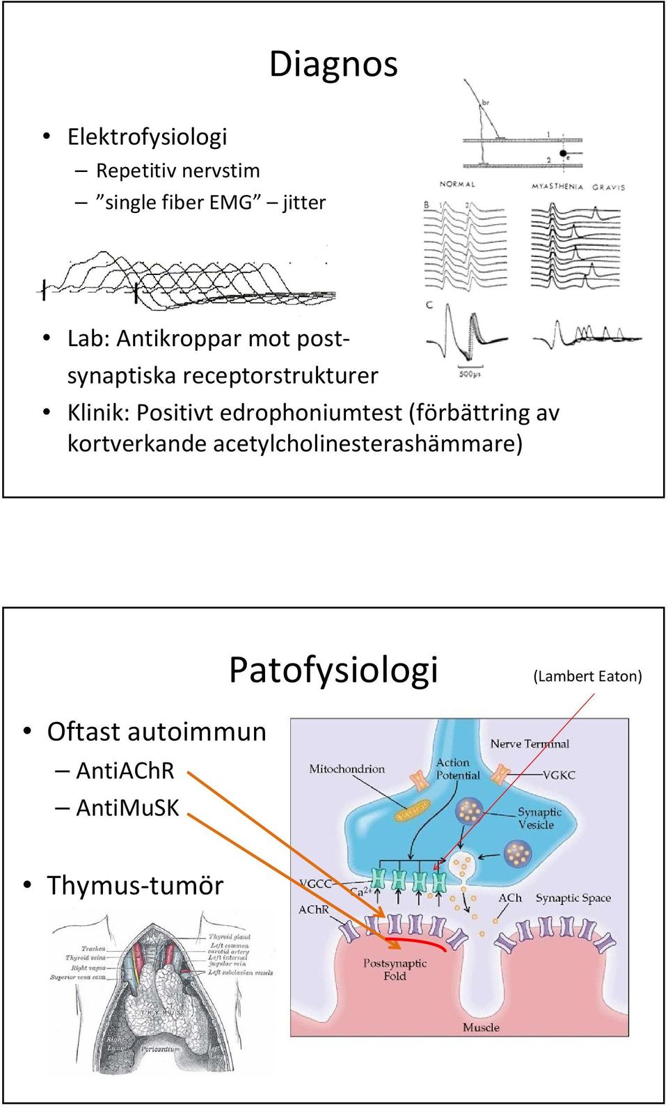 edrophoniumtest (förbättring av kortverkande acetylcholinesterashämmare)