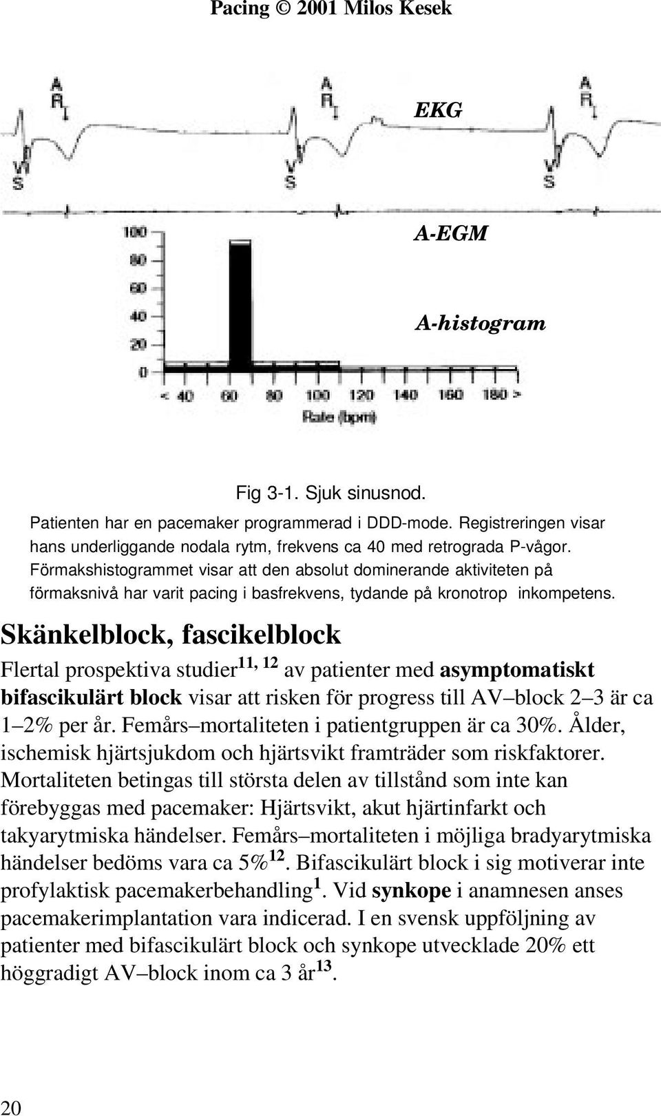 Förmakshistogrammet visar att den absolut dominerande aktiviteten på förmaksnivå har varit pacing i basfrekvens, tydande på kronotrop inkompetens.