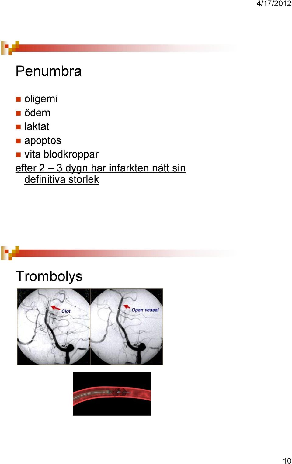 2 3 dygn har infarkten nått