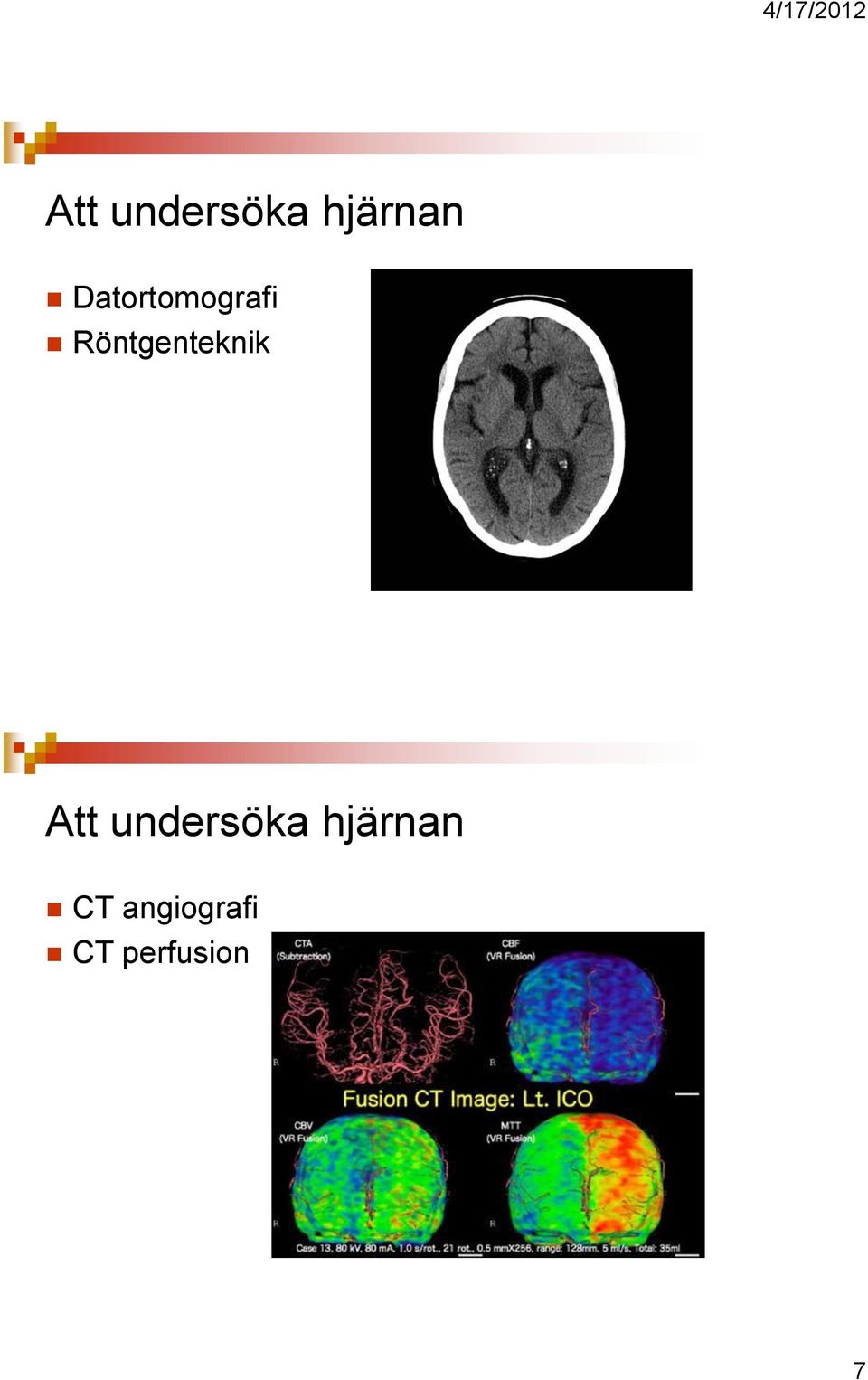 Röntgenteknik  CT