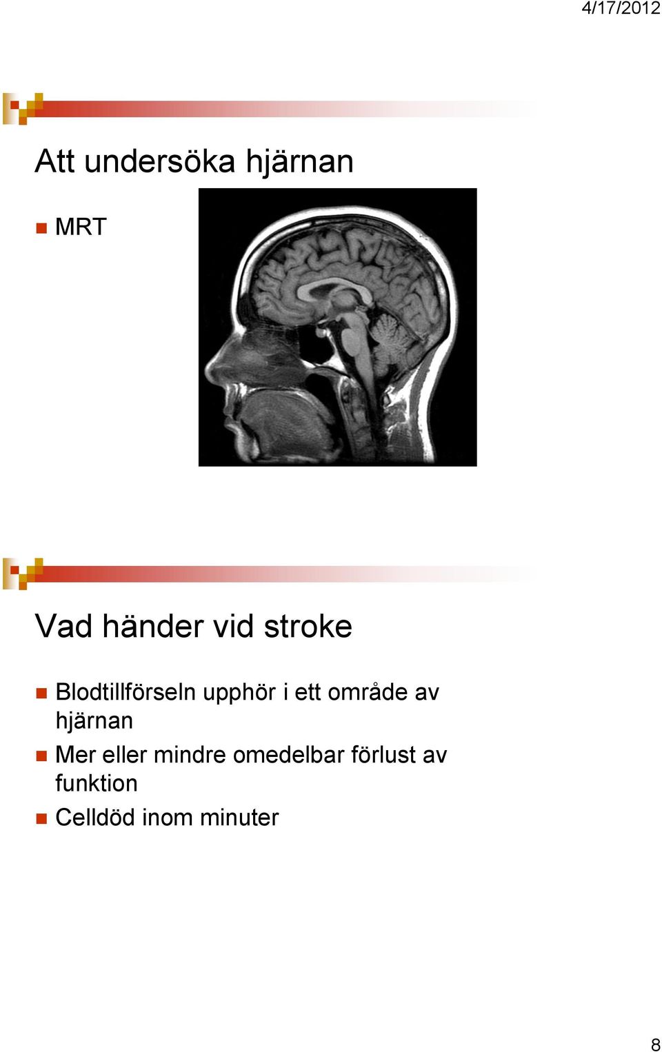 område av hjärnan Mer eller mindre