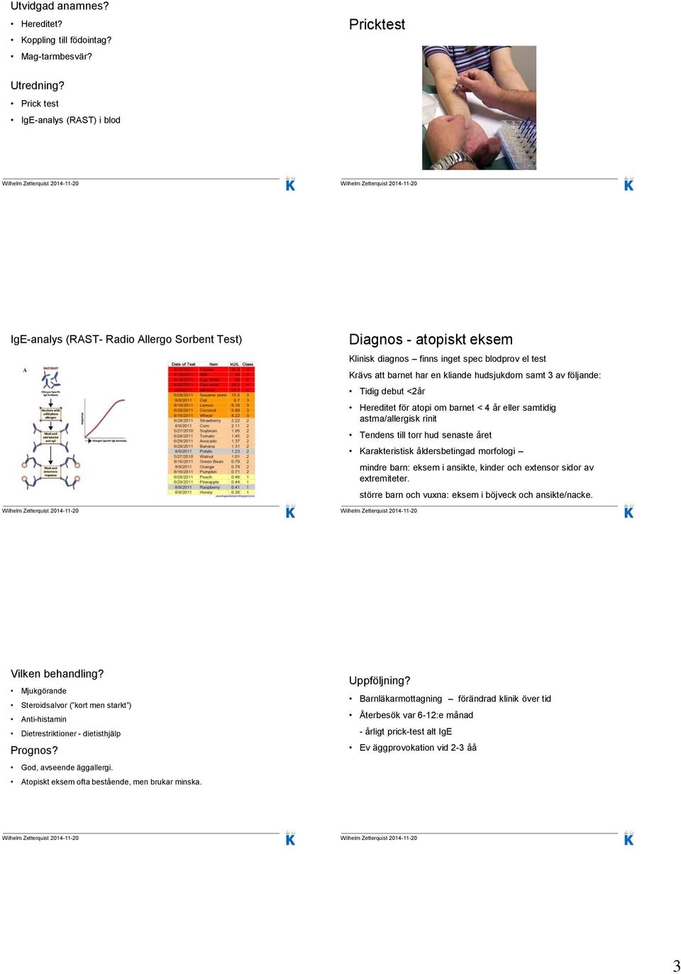 samt 3 av följande: Tidig debut <2år Hereditet för atopi om barnet < 4 år eller samtidig astma/allergisk rinit Tendens till torr hud senaste året Karakteristisk åldersbetingad morfologi mindre barn: