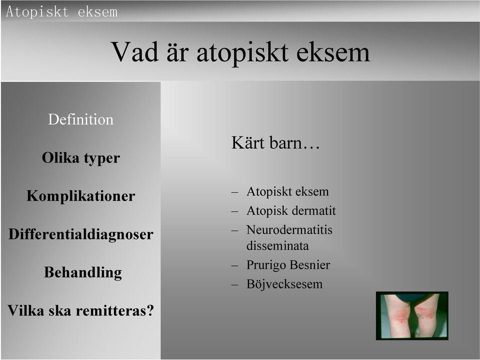 dermatit Neurodermatitis