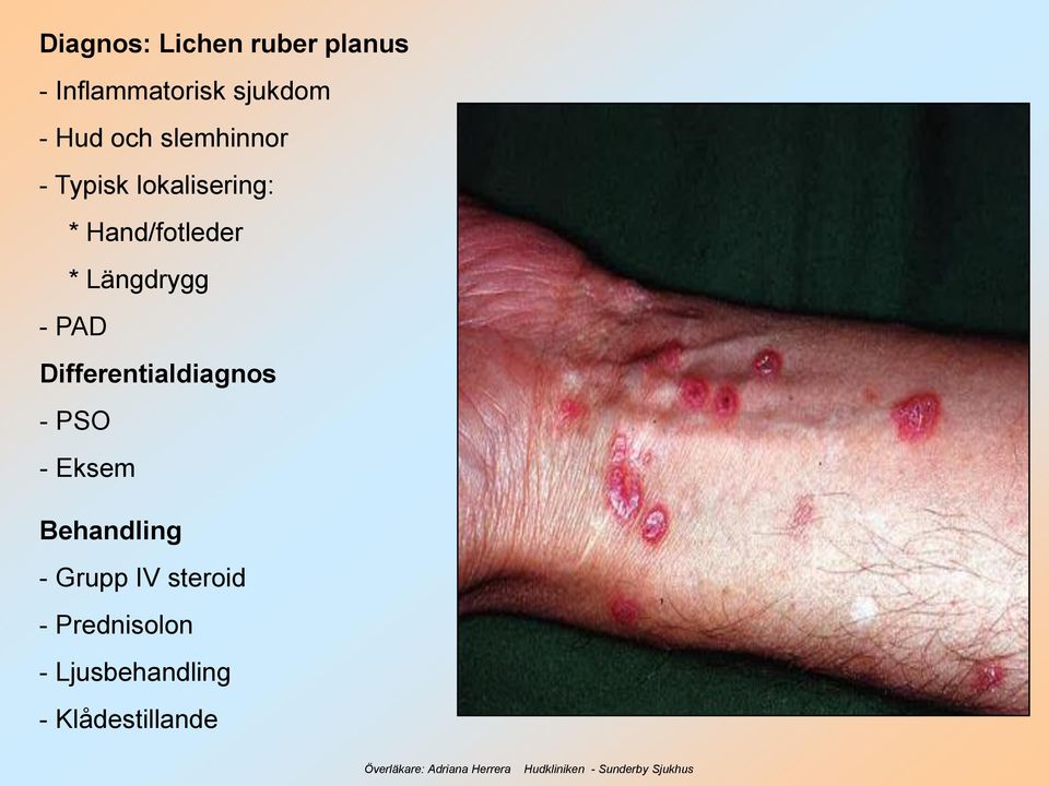 Längdrygg - PAD Differentialdiagnos - PSO - Eksem Behandling