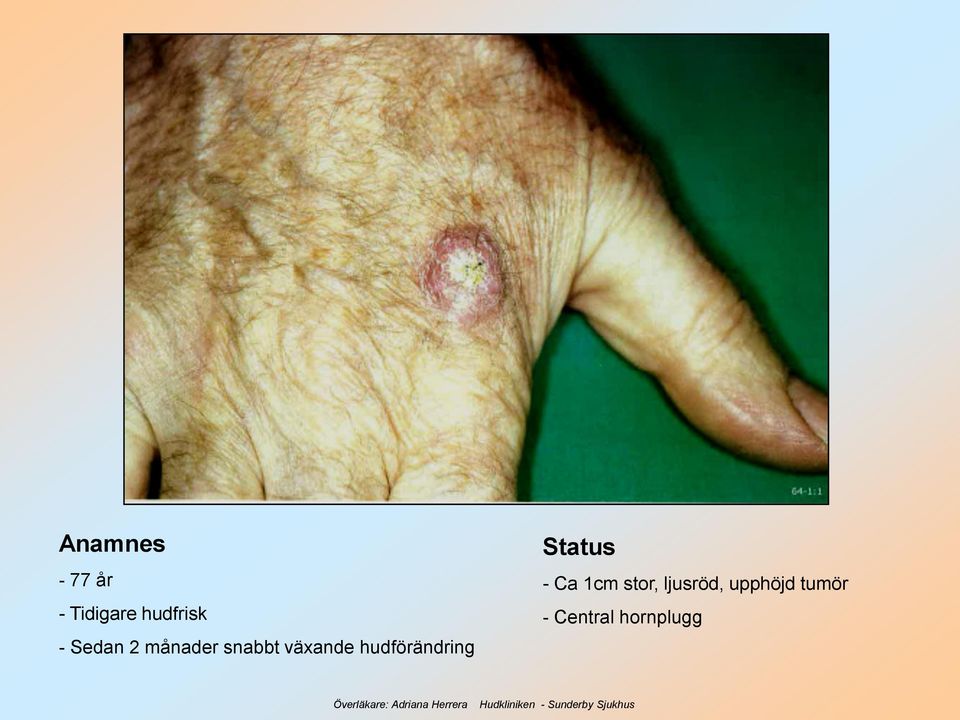 hudförändring Status - Ca 1cm stor,