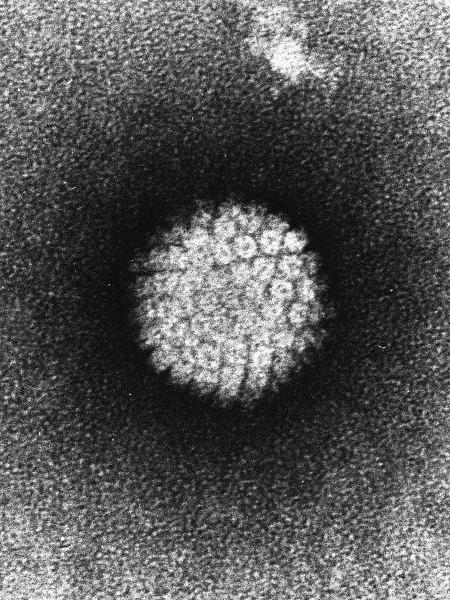 Infektion med HPV (humant papillomvirus) Är den vanligaste sexuellt överförda infektionen hos kvinnor och män Drabbar de flesta sexuellt aktiva Infekterar hudens