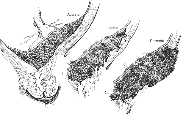 Placenta