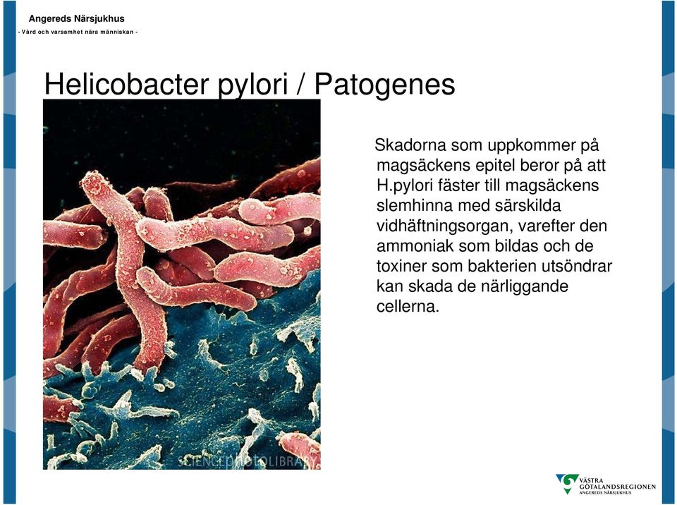 pylori fäster till magsäckens slemhinna med särskilda