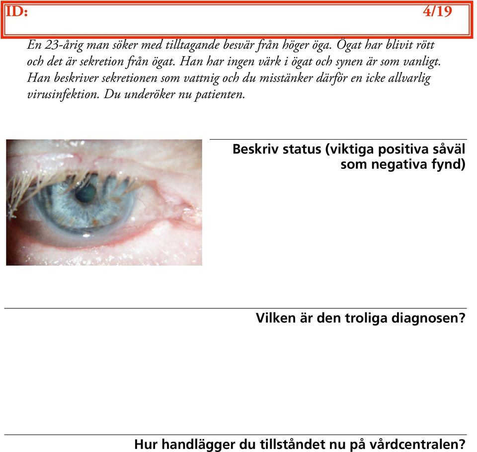 Han beskriver sekretionen som vattnig och du misstänker därför en icke allvarlig virusinfektion.